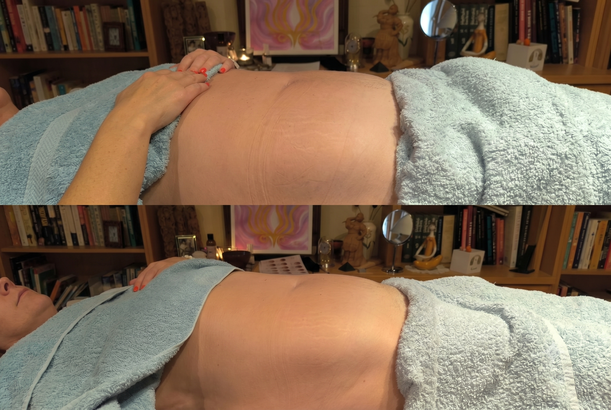 Belly Revolution treatment